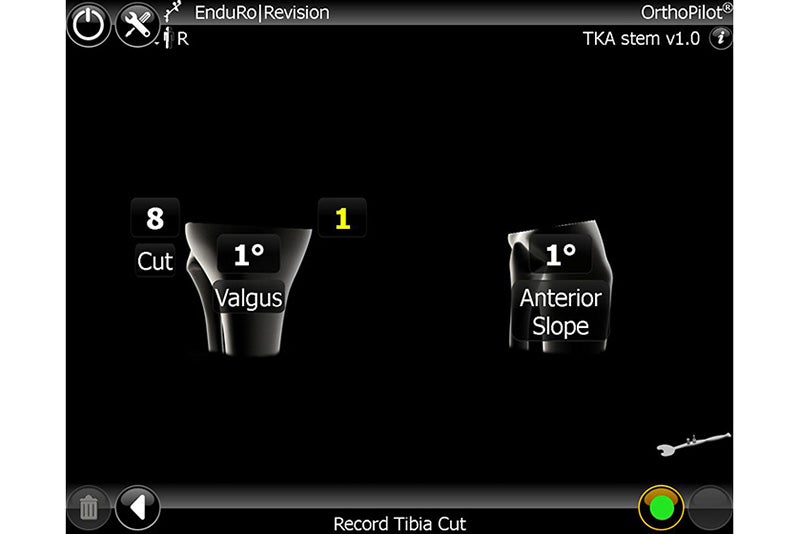 Record Tibia Cut