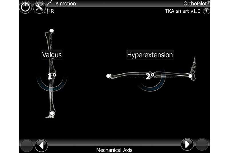 Mechanical Axis