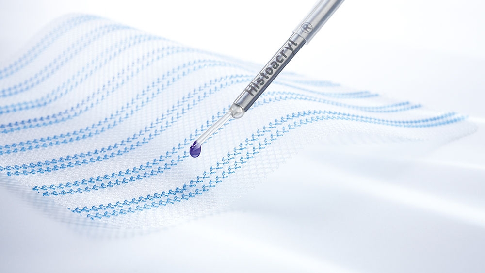 Kirurgisk mesh med Histoacryl® LapFix applikator til mesh fiksering