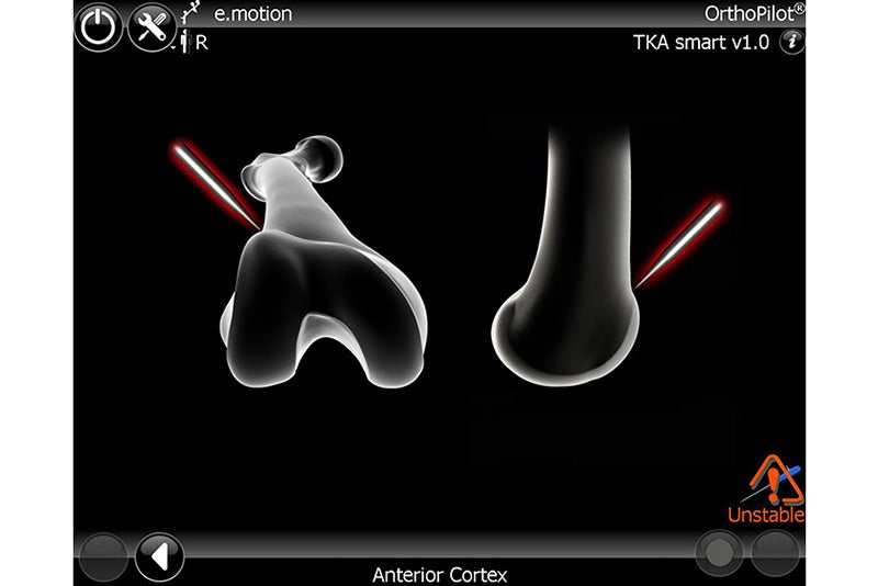 Anterior Cortex