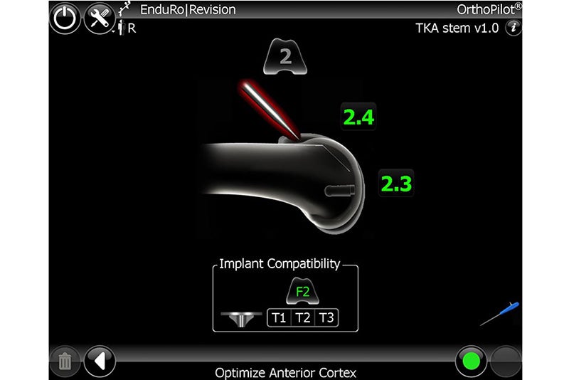 Optimize Anterior Cortex