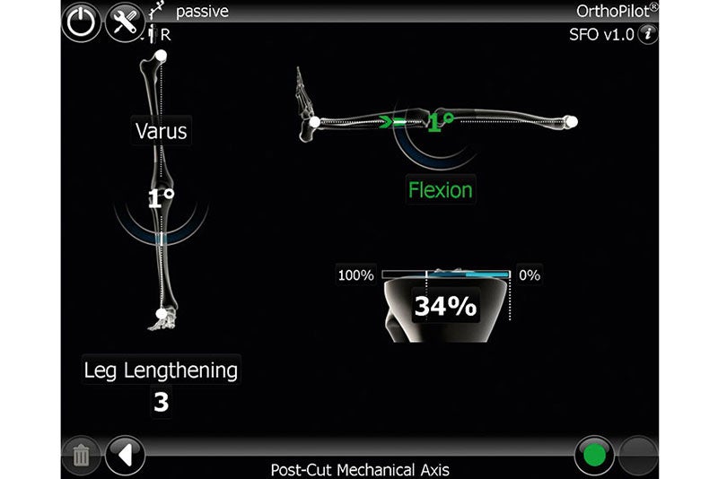 Post-Cut Mechanical Axis