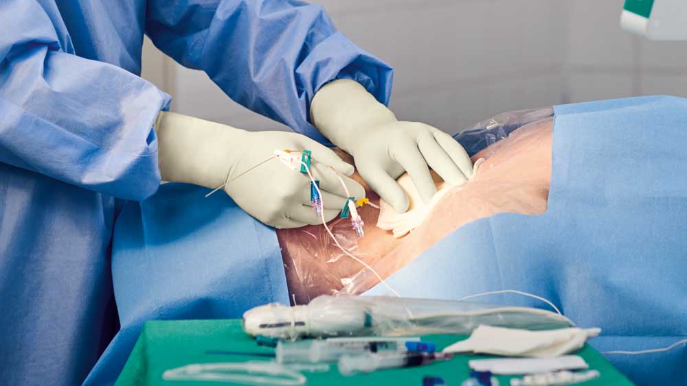 Placering af et centralt indført kateter i et sterilt felt, herunder komponenter og udstyr.